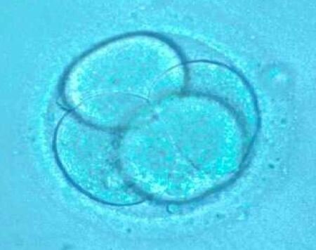 embrione di mammifero (scimmia)